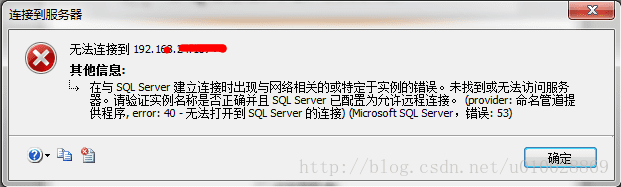 SQLServerԶʧô죿