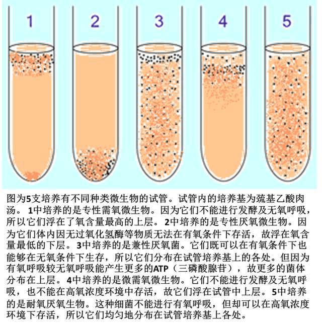 細菌的需氧/厭氧模式示意圖,來源:умовский А.Н.